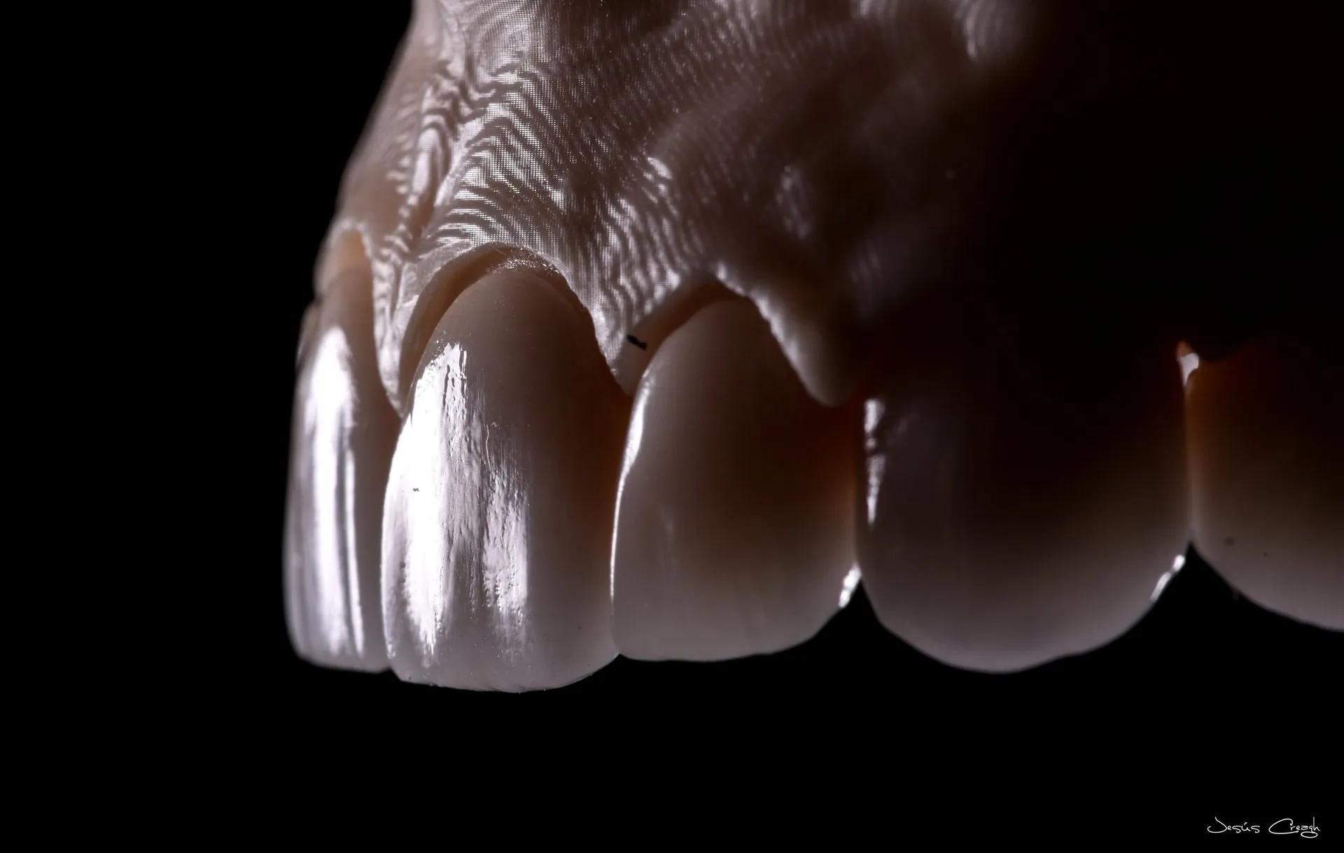 Próteses dentárias personalizadas produzidas no PHI Dental Lab, São Paulo